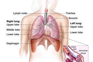CÁC YẾU TỐ NGUY CƠ UNG THƯ PHỔI